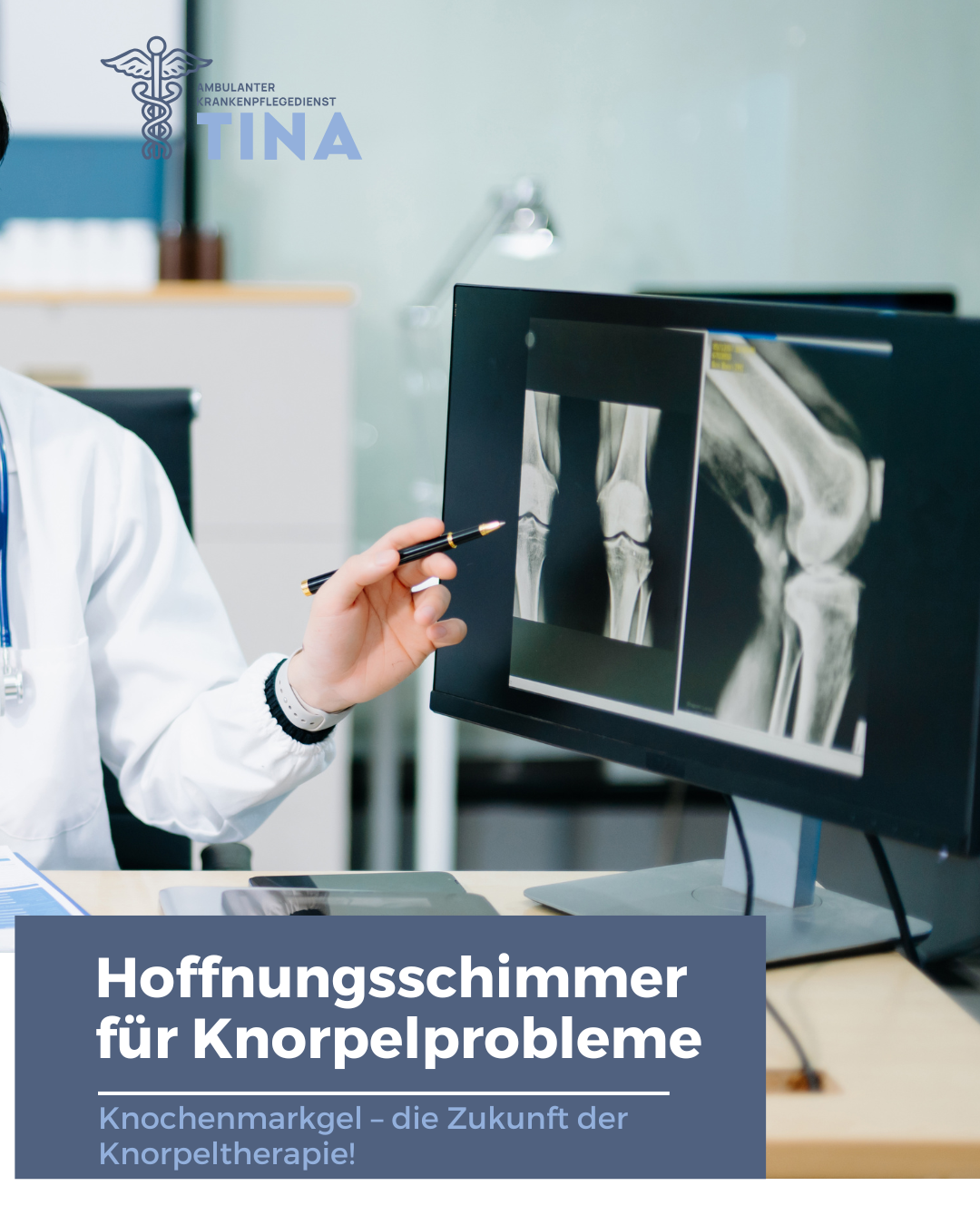 Auf dem Bild ist ein Computerbildschirm zu sehen. Auf diesem sieht man eine Röntgen Aufnahme eines Knies. Man sieht den Arm einer Person mit weißem Kittel, die auf die Aufnahme zeigt. Symbolisch für: Knochenmarkgel: Die neue Hoffnung für Knorpelschäden