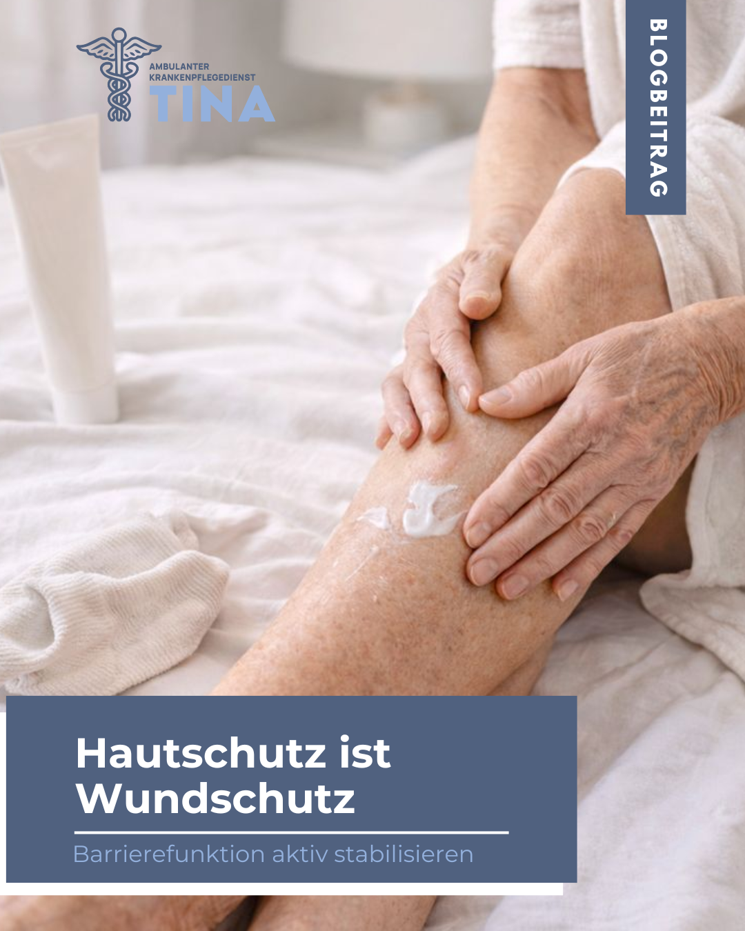 Auf dem Bild sieht man, wie jemand sich das Bein eincremt, symbolisch für Trockene Haut im Alter – Ursachen, Pflege & Hilfe durch Pflegedienst Tina.